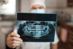 Male dentist holding up x-ray