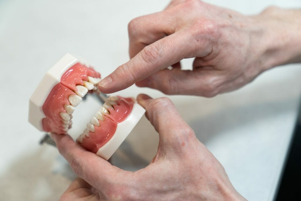 Hands holding and pointing at dental implants mold