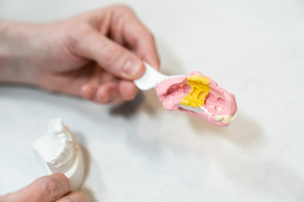 Hands holding mold for dental crowns